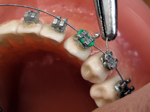 Ortodonti nedir?